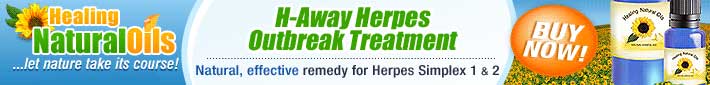 Herpes Treatment