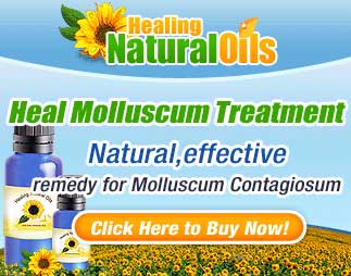 Molluscum Treatment