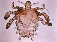 The pubic lice, also known as the crab louse, slang crabs 