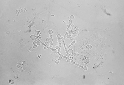 This microscopic image shows the candida yeast has reached and  infection stage of development