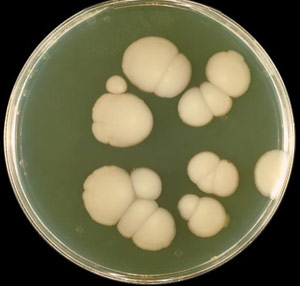 Although grown in a petrie dish, this yeast infection has the charactersitic curdy cheese appearance that often happens in vaginal yeast infection.