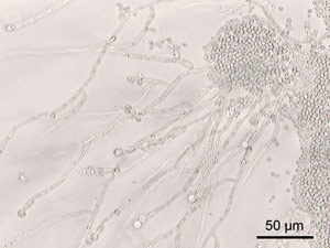 This is what a yeast infection looks like under the microscope